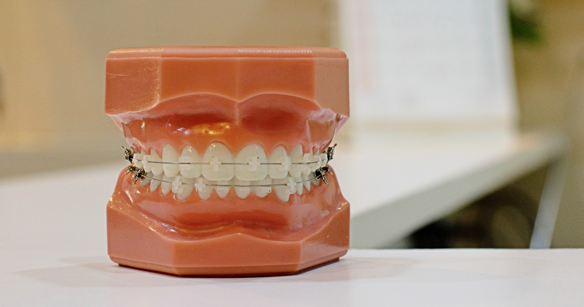 Detergent Food Superfoods That Are Great For Oral Hygiene